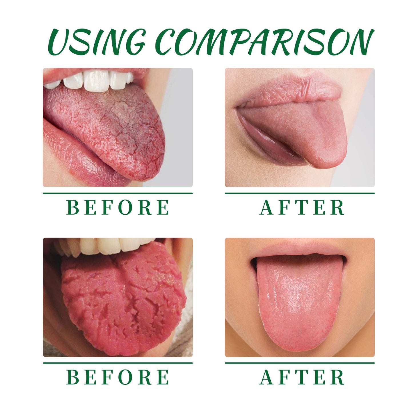 EELHOE Tongue Repair Spray Oral Care Relief for White Coated Dry Swollen Tongue Fresh Breath Spray